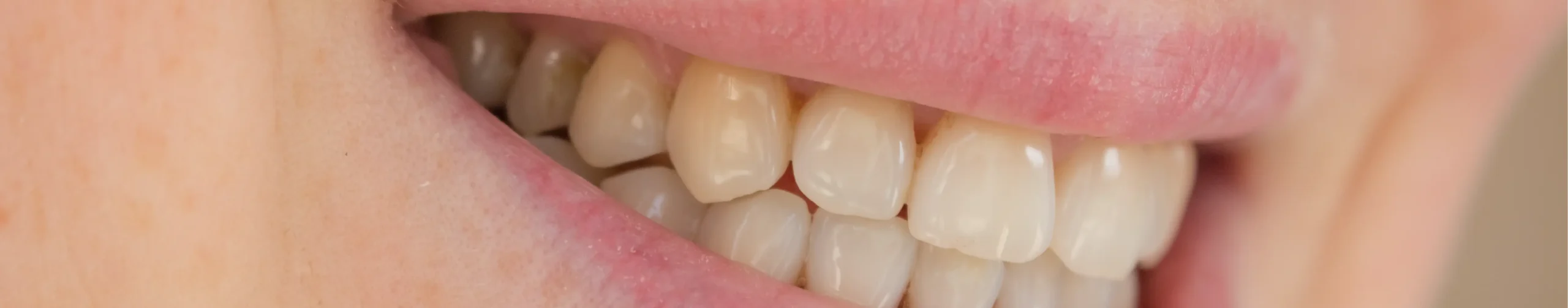 danni da ortodonzia